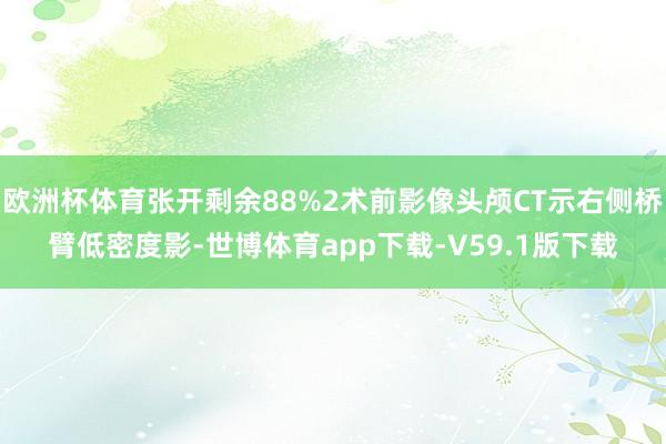 欧洲杯体育张开剩余88%2术前影像头颅CT示右侧桥臂低密度影-世博体育app下载-V59.1版下载